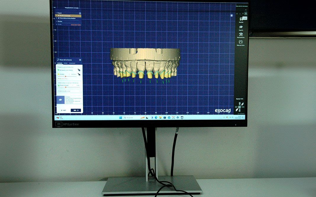 Sistema CAD/CAM en Madrid | ArtDent