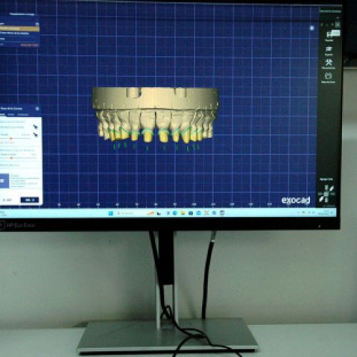 Estructura CAD CAM