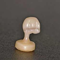 Prótesis fija sin metal