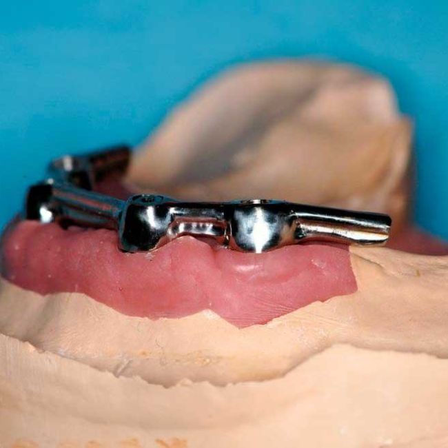 Prótesis dentales con materiales homologados | ArtDent